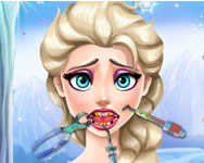 orvosos - Elsa tooth injury