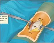 Virtual knee surgery orvosos jtkok